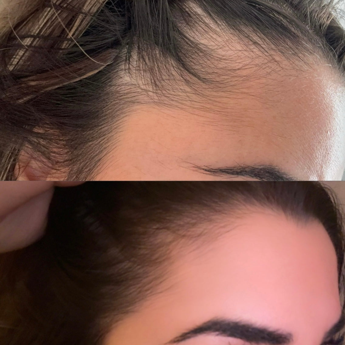 HerbaGlow Bioactive Herbal Hair Oil (with DHT blockers)
